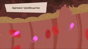 Остановка кровотечения в поврежденном сосуде