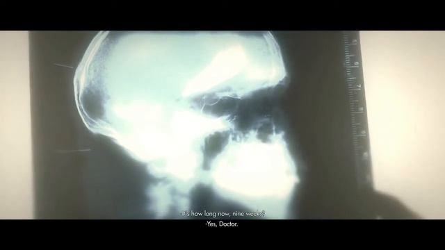 Lets Play Wolfenstein: The New Order Xbox One - Part 7