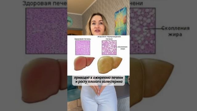 ❌Эти продукты повреждают ПЕЧЕНЬ#ожирение печени#вредные заменители сахара#фруктоза#нутрициолог