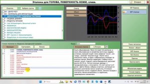 2024-07-24_150411-ПО Дианел®-2.1. обучение работе, Эталоны D,F - диета, химические пищевые добавки