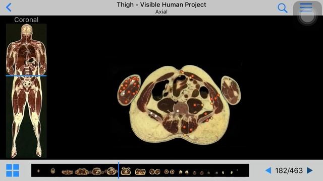 Full body MRI - From e-Anatomy