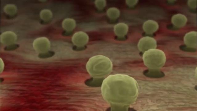 Johns Hopkins Medicine | Aplastic Anemia смотреть онлайн