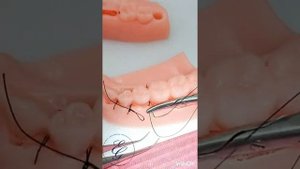 The suture technique/ Tikiş texnikası #3 / Техника наложения швов в полости рта.