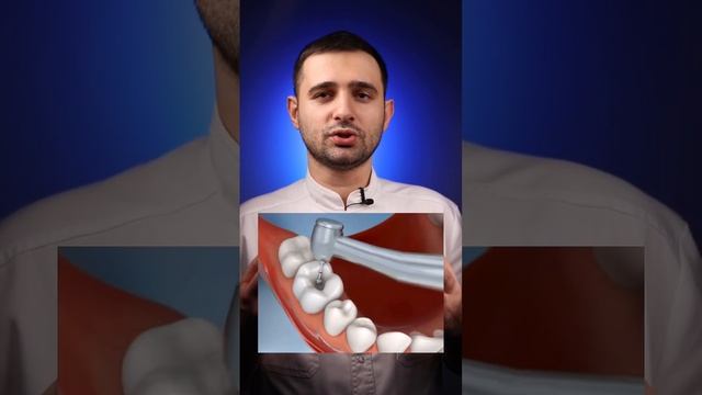 Что такое пломба? смотреть онлайн