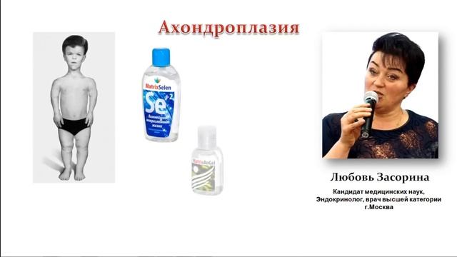 Ахондроплазия рассказывает врач Любовь Засорина Power Matrix смотреть онлайн