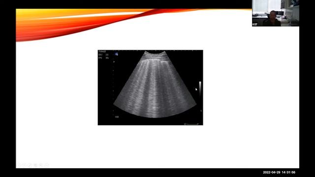 Thoracic Ultrasound смотреть онлайн
