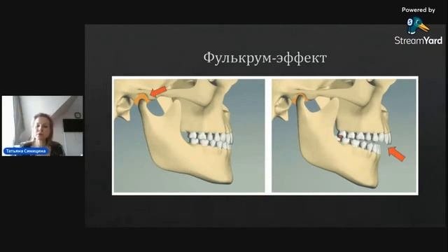 Татьяна Синицина - анатомия и физиология ВНЧС