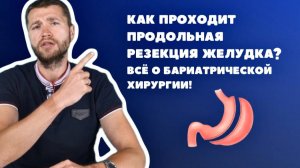 Как проходит продольная резекция желудка? Всё о бариатрической хирургии!