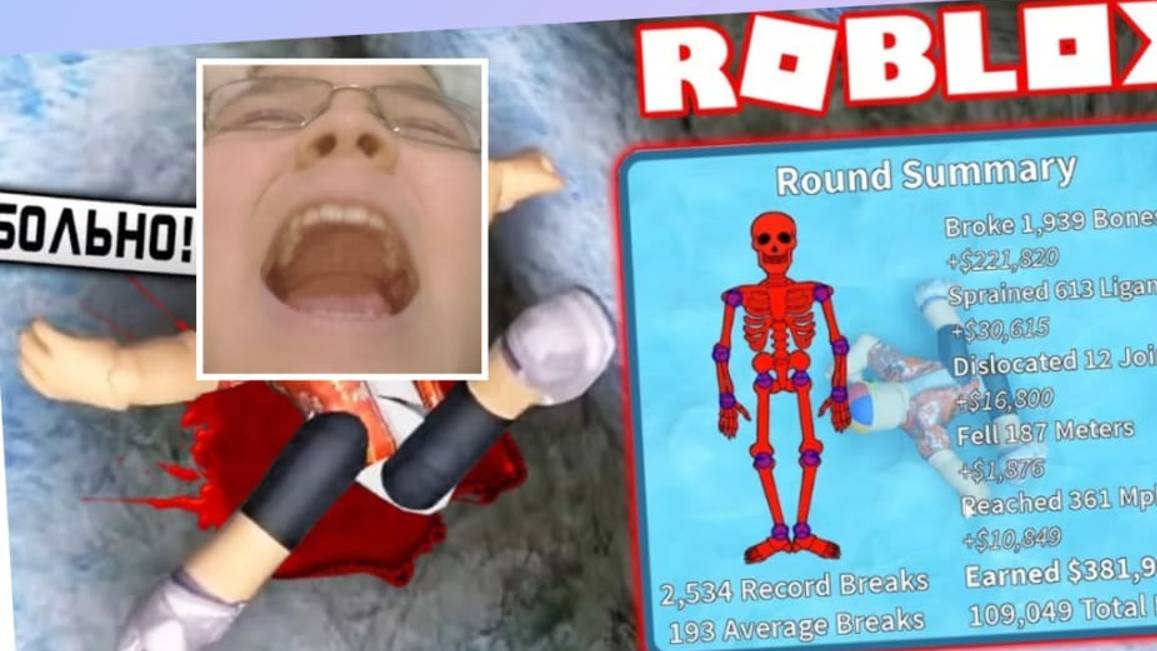 Радмир сломал мизинчик на ноге..... смотреть онлайн