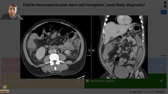 Radiology Quiz | Kahoot | 2nd Edition | Gamification | March 2021 смотреть онлайн