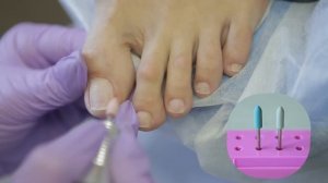 Аппаратный педикюр. Технология выполнения.