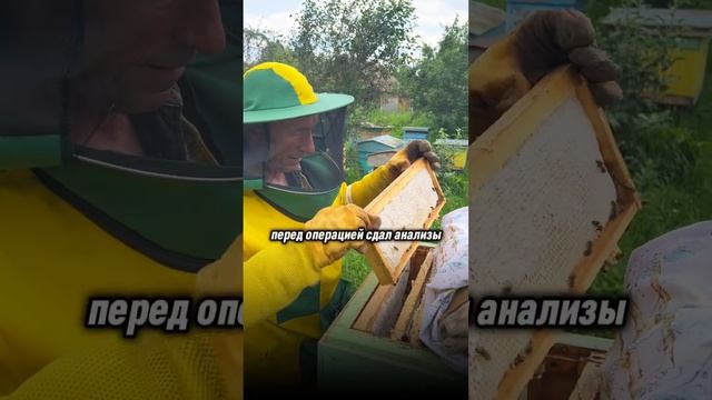 Вылечил язву ПРОПОЛИСОМ. Прополис - самый сильный антибиотик