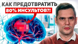 Инсульт МОЖНО ИЗБЕЖАТЬ! Простые действия, которые помогут предотвратить Инсульт