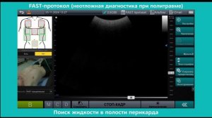 FAST протокол