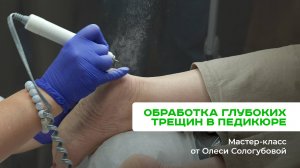 Обработка глубоких трещин в педикюре разными способами. Мастер-класс от Олеси Сологубовой