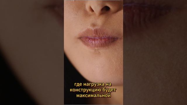 Зубные мосты всё, что нужно знать!