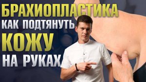 Брахиопластика (подтяжка кожи рук): показания к операции и техника выполнения / Сергей Свиридов