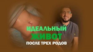 Плоский живот после трех родов