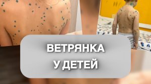 Ветрянка у детей 3х и 6ти лет. Болезнь ветрянка, течение болезни, лечение и выздоровление.