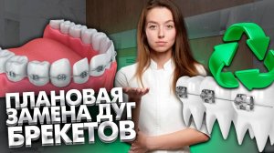 Плановая замена дуги брекет-системы