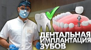 Как проводится дентальная имплантация в Сочи?