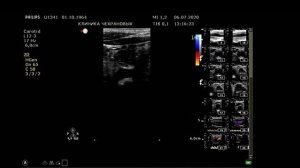 УЗИ сонных артерий в Уссурийске Клиника Чехрановых 2020 07 06 13 04 42