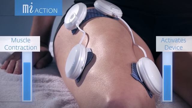 Chattanooga Wireless Pro - Product Video смотреть онлайн