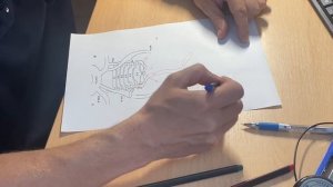 Вертебро-базилярная недостаточность. Объяснение сегодняшнего обследования.