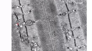 Лекция 8. Мышечные ткани | Глинкина В.В.