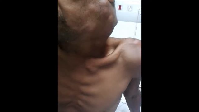 linfoma..... смотреть онлайн