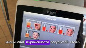 Знакомство с аппаратом Fotona 4D Pro