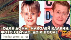 «Один дома» Маколей Калкин: фото сейчас, до и после