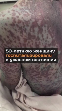 53-летнюю женщину гocnuтaлuзupoвaлu в ужасном состоянии