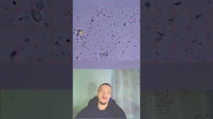 Как Куркума борется с грибком в кишечнике #грибок  #здоровье #кандида  #подмикроскопом #кишечник