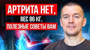 Артрита нет, вес 86 кг, полезные советы вам