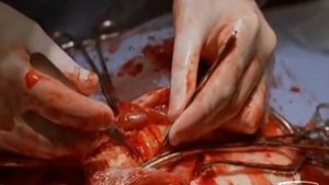 When Things Fall Apart