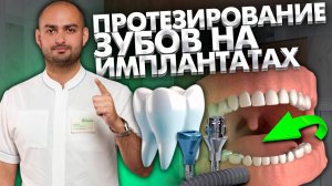 Тотальное протезирование на имплантатах с костной пластикой и синус-лифтингом