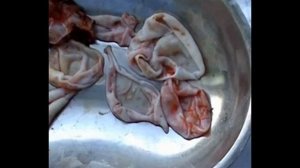 эхинококкоз