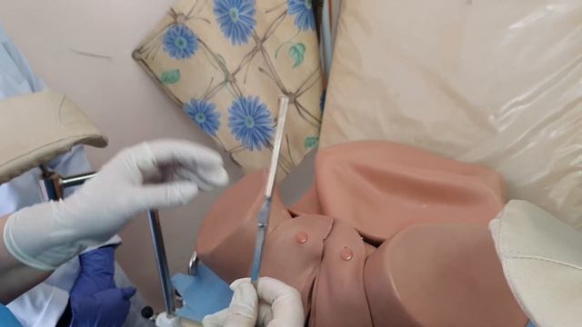 Алгоритм проведения амниотомии
