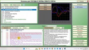 2024-07-24_172208-ПО Дианел®-2.1. обучение работе, Спец. функция Поиск Патологии и её применение