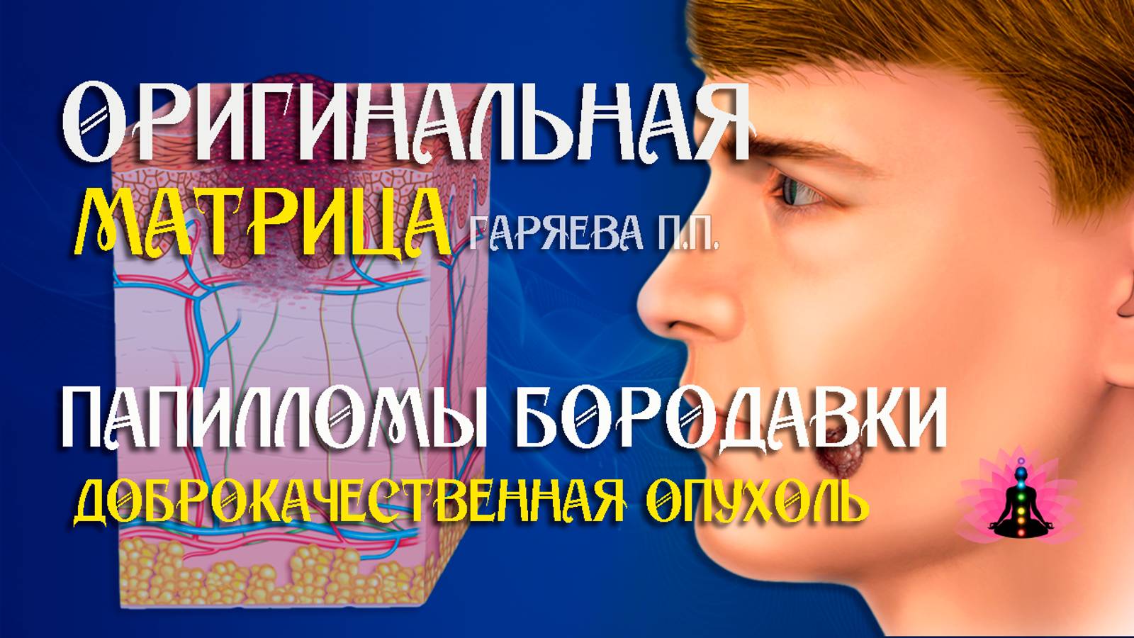 Вирус папилломы, бородавки » ⚠️ Оригинальная матрица Гаряева П.П ☀️ SoftRadio.ru