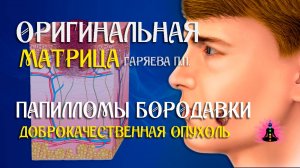 Вирус папилломы, бородавки ⚠️ Оригинальная программа матрица по технологии Гаряева ☀️ SoftRadio.ru