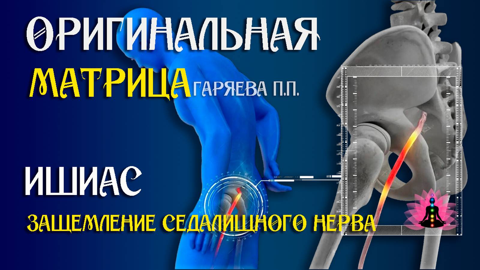 Ишиас» ⚠️ Оригинальная (чистая) матрица Гаряева П.П ☀️ SoftRadio.ru