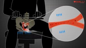 Кровообращение в области таза у мужчин при использовании стула-седла SALLI