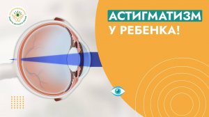 Астигматизм у детей: как распознать и что делать?
