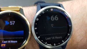 Garmin Venu 4 - First Look, Leaks, Big Features and Release Date, 2024 🔥