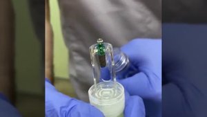 Имплантация зубов в Москве.