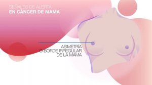 Señales de alerta en cáncer de mama