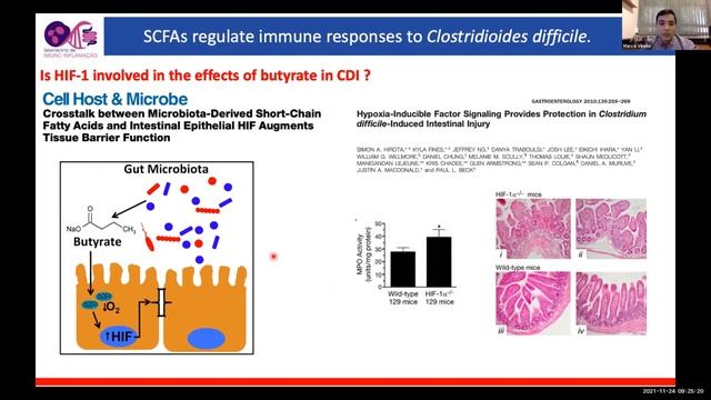 Short-chain fatty acids:small molecules from microbiota w big impact in the host by Dr. Marco Vinol