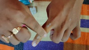 how to use himalaya himcolin gel | himalaya himcolin gel | himalaya himcolin gel review in Bengali